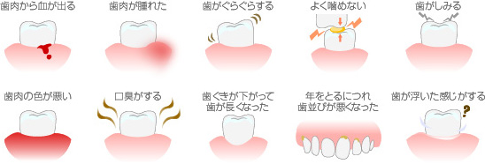 このような症状がある方は歯周病の可能性があり那須